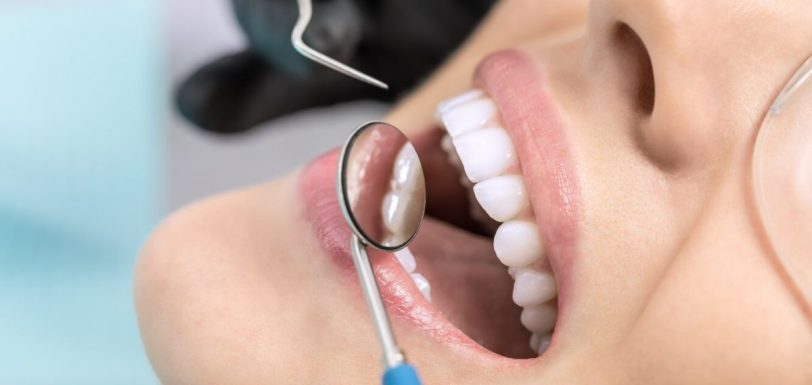 aplicação de flúor nos dentes