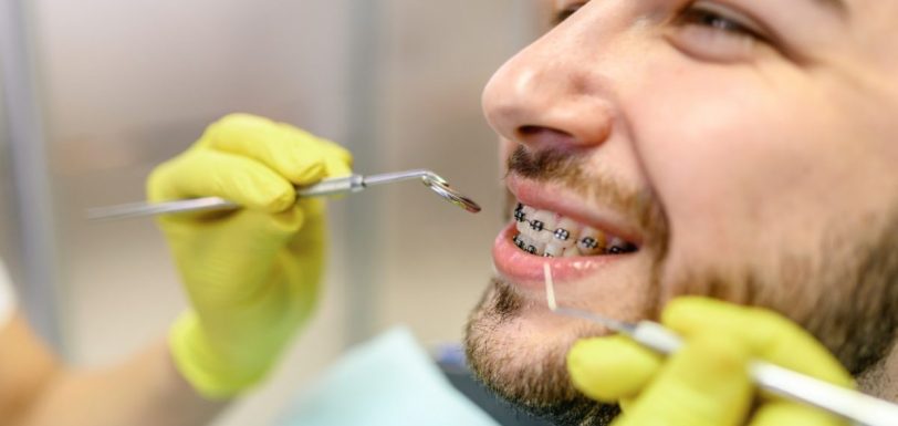 mito aparelho ortodontico