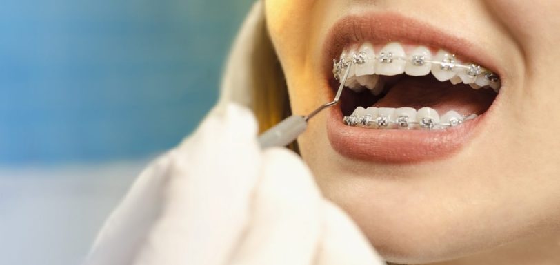 tipos de ortodontia