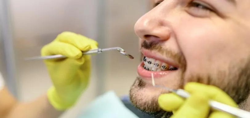 mito aparelho ortodontico